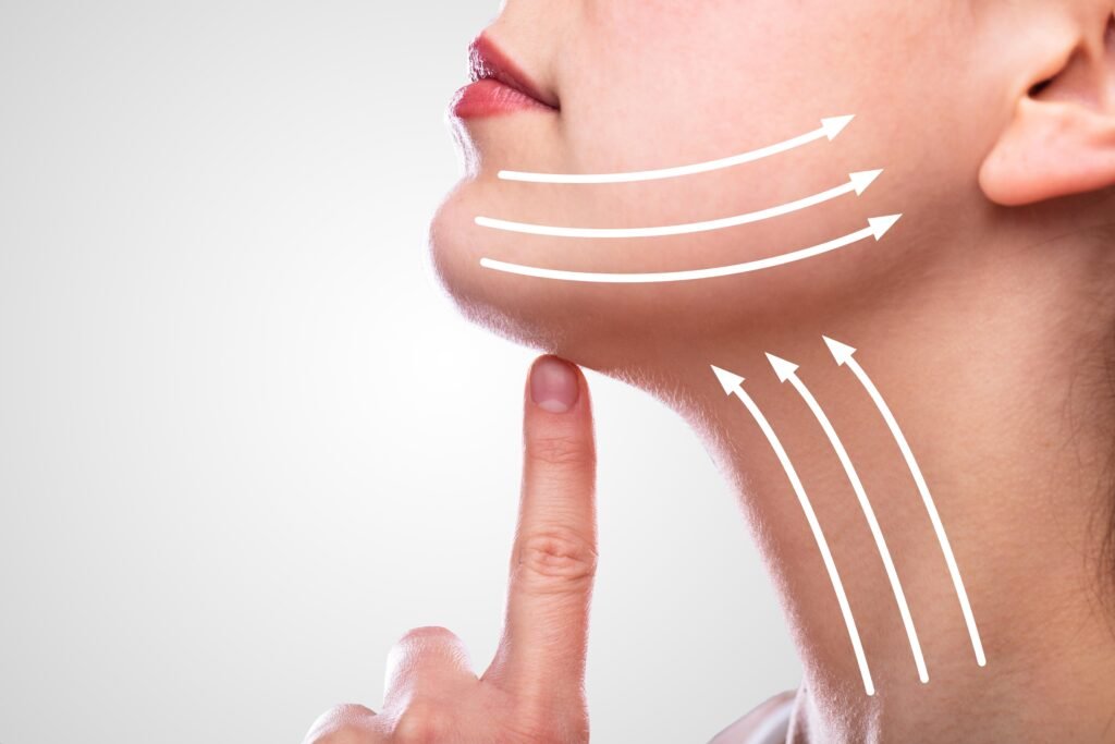 Liposuccion du double menton pour redéfinir l ovale du visage