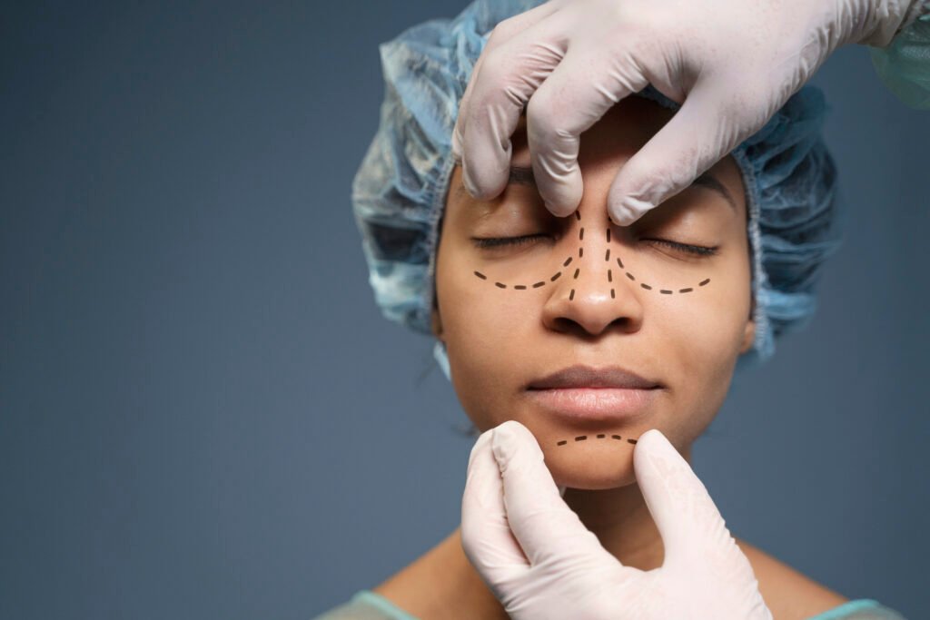 Chirurgie de rhinoplastie ouverte pour les corrections nasales complexes