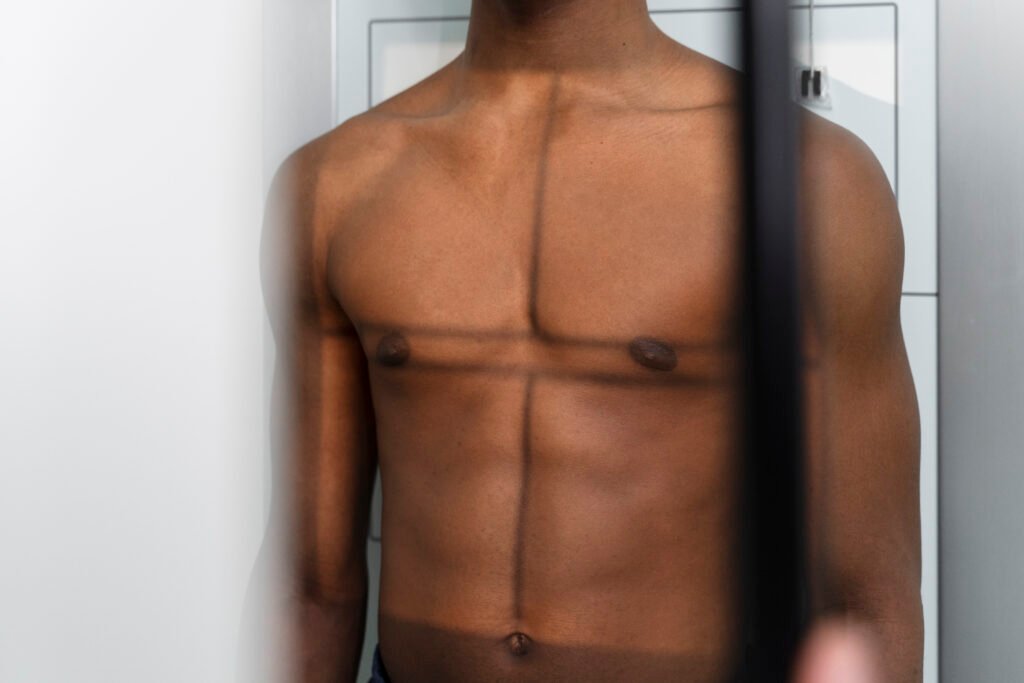 Chirurgie de la gynécomastie pour hommes chez Cayra Clinic